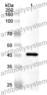 Anti-Mycoplasma pneumoniae mgpA/Adhesin P1 Polyclonal Antibody